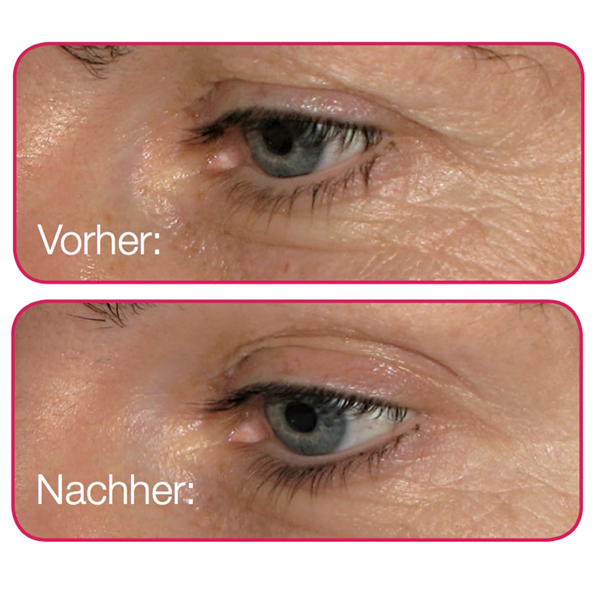 Vorher/Nachher